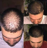 Dr. C. Tuna Reviving Hair Oil: Nourish and Restore Your Hair's Natural Brilliance hair loss treatment