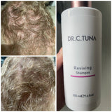 Dr. C. Tuna Reviving Hair Oil: Nourish and Restore Your Hair's Natural Brilliance hair loss treatment
